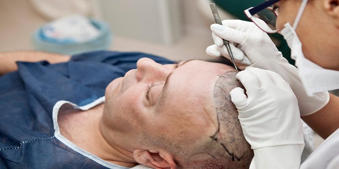 Pioneering the Future: AI's Promising Role in Improving Hair Transplant Procedures